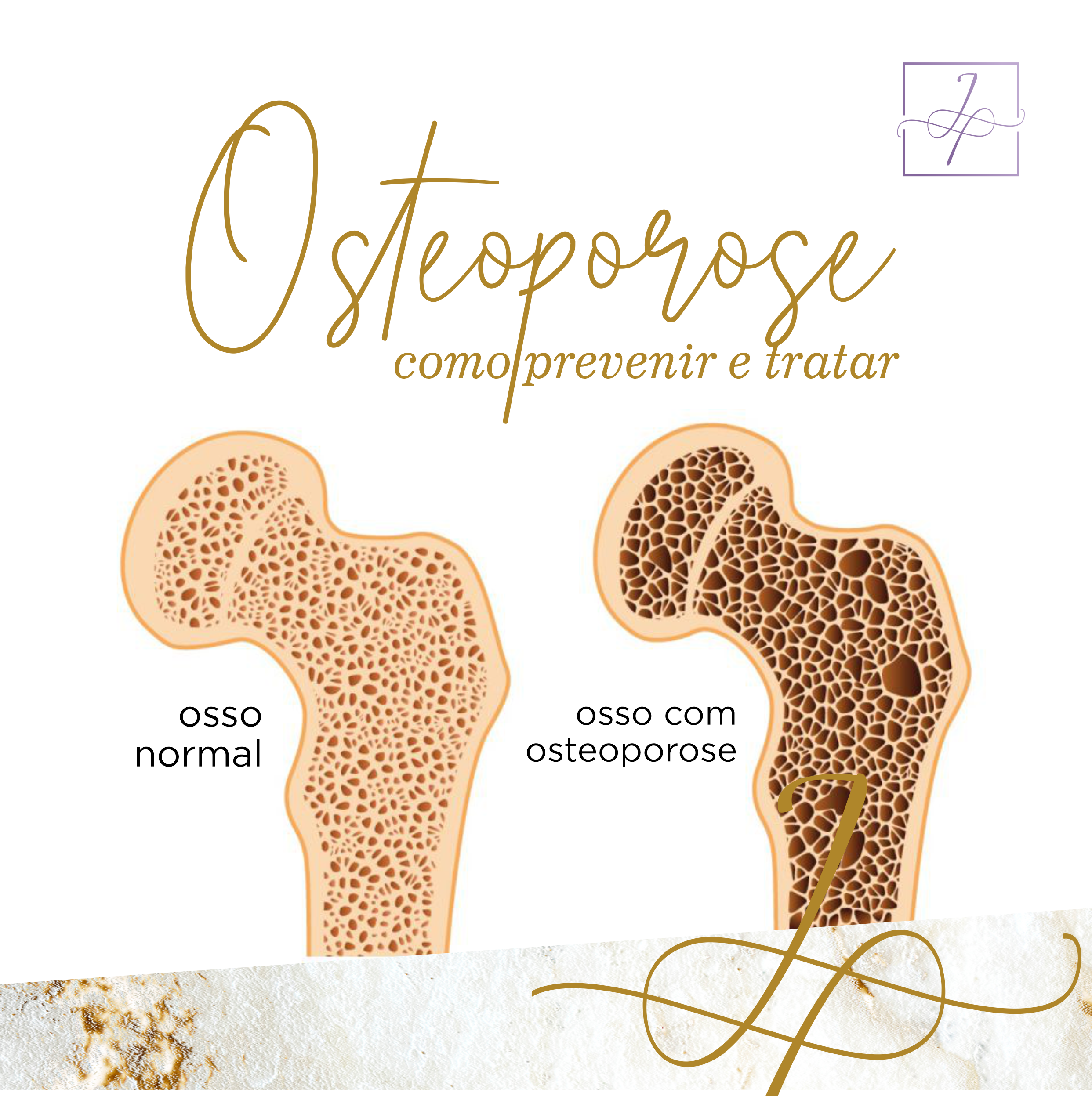 Osteoporose
