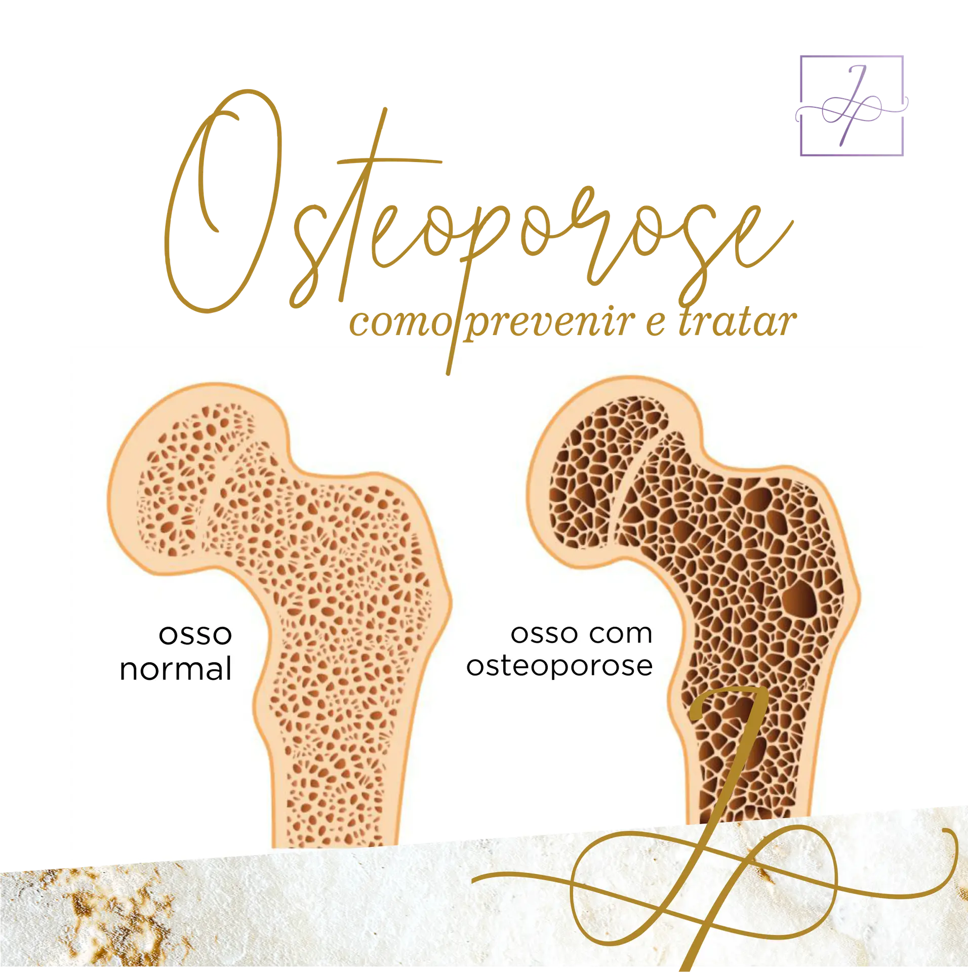 Osteoporose